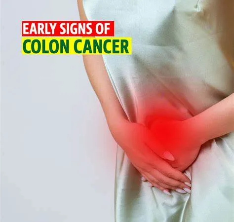 توقف عن هذه العادة لتقليل خطر الإصابة بسرطان القولون والمستقيم 6 - CJ العربية Colorectal Cancer Risk - CJ العربية