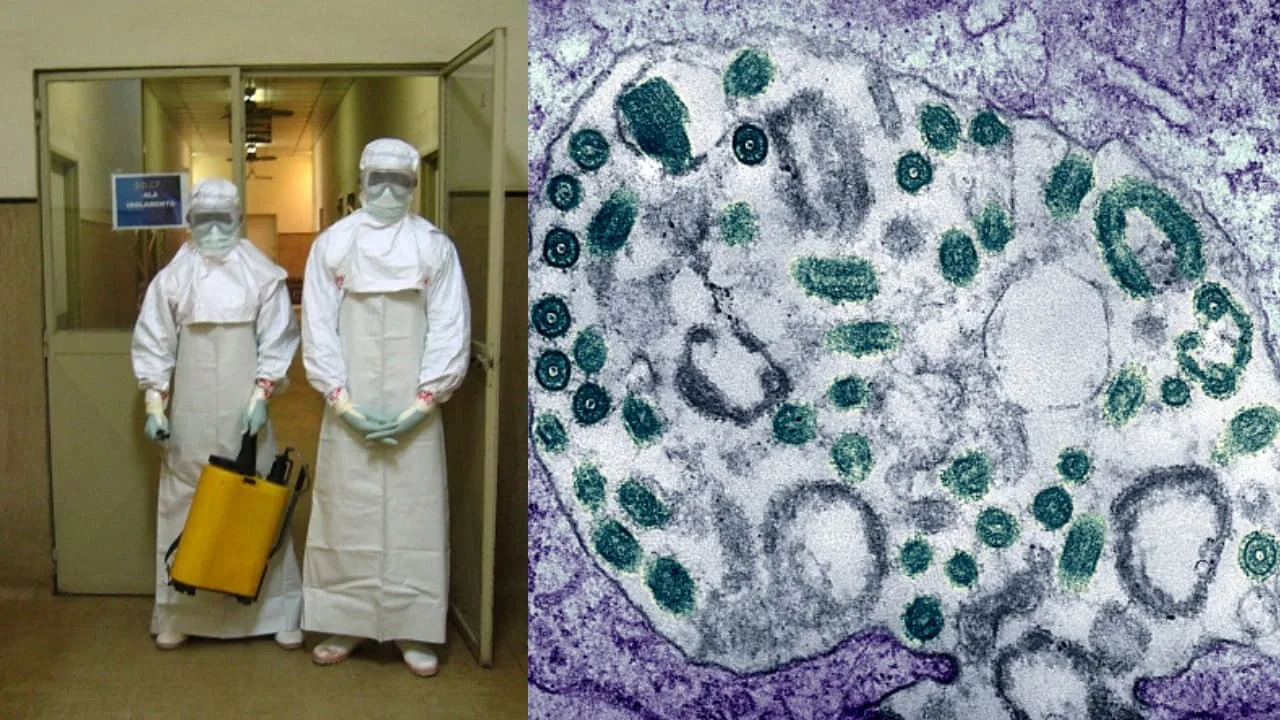 إثيوبيا تؤكد تفشي فيروس ماربورغ الفتاك، وهو مرض شبيه بالإيبولا 5 - CJ العربية فيروس الماربوغ في اثيوبيا